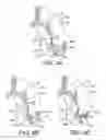 Fig. 06 - COORDINATED DELIVERY OF COPD TREATMENT