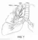 Fig. 09 - COORDINATED DELIVERY OF COPD TREATMENT