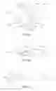 Fig. 06 - Cut guide attachment for use in tibial prosthesis systems