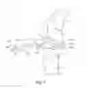 Fig. 09 - Cut guide attachment for use in tibial prosthesis systems
