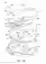 Fig. 15 - Cut guide attachment for use in tibial prosthesis systems