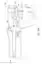 Fig. 25 - Cut guide attachment for use in tibial prosthesis systems