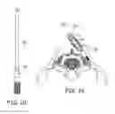 Fig. 08 - TOOLS FOR PERFORMING LESS INVASIVE ORTHOPEDIC JOINT PROCEDURES