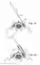 Fig. 10 - TOOLS FOR PERFORMING LESS INVASIVE ORTHOPEDIC JOINT PROCEDURES