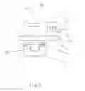 Fig. 04 - Customized surgical cutting guide for total knee replacement and method for making thereof
