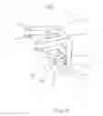 Fig. 09 - Customized surgical cutting guide for total knee replacement and method for making thereof