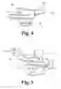 Fig. 04 - Low profile patient specific cutting blocks for a knee joint