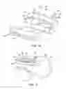 Fig. 11 - Systems and methods for installing an orthopedic implant