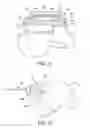 Fig. 12 - Systems and methods for installing an orthopedic implant