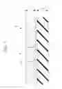 Fig. 04 - Endoscope treatment tool
