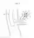 Fig. 06 - Endoscope treatment tool