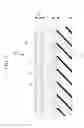 Fig. 10 - Endoscope treatment tool