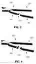 Fig. 06 - Manipulator for grasping tissue