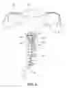 Fig. 04 - Uterine manipulator device with cutting element