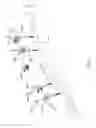 Fig. 02 - External fixator assembly