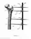 Fig. 03 - External fixator assembly