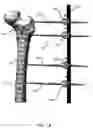 Fig. 03 - External fixator assembly