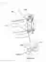 Fig. 06 - Medical device for pectus excavatum deformity correction surgery