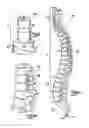 Fig. 08 - SPINAL IMPLANT APPARATUSES AND METHODS OF IMPLANTING AND USING SAME