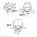 Fig. 09 - SPINAL IMPLANT APPARATUSES AND METHODS OF IMPLANTING AND USING SAME