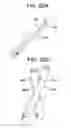 Fig. 26 - PERCUTANEOUS ACCESS DEVICES AND BONE ANCHOR ASSEMBLIES