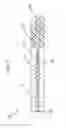 Fig. 11 - Systems and methods for posterior dynamic stabilization of the spine
