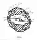 Fig. 14 - Systems and methods for posterior dynamic stabilization of the spine