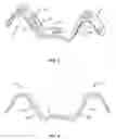 Fig. 03 - Spinal implant system and methods of use