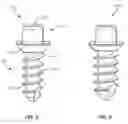 Fig. 04 - Spinal implant system and methods of use
