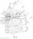Fig. 09 - Spinal implant system and methods of use