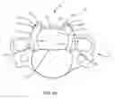 Fig. 10 - Spinal implant system and methods of use