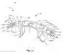 Fig. 11 - Spinal implant system and methods of use