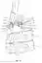 Fig. 12 - Spinal implant system and methods of use