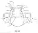 Fig. 13 - Spinal implant system and methods of use
