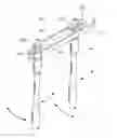Fig. 01 - Instruments and methods for manipulating vertebra