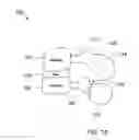Fig. 02 - BONE PLATES CONFIGURED TO RIGIDLY FIX FRAGMENTS OF A BONE TO ONE ANOTHER