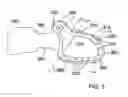 Fig. 05 - BONE PLATES CONFIGURED TO RIGIDLY FIX FRAGMENTS OF A BONE TO ONE ANOTHER