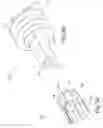 Fig. 06 - System and method for reducing and stabilizing fractures in bone, subluxations, or dislocations