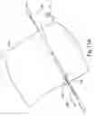 Fig. 12 - System and method for reducing and stabilizing fractures in bone, subluxations, or dislocations