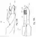 Fig. 15 - System and method for reducing and stabilizing fractures in bone, subluxations, or dislocations