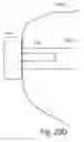 Fig. 28 - System and method for reducing and stabilizing fractures in bone, subluxations, or dislocations