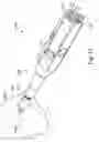 Fig. 33 - System and method for reducing and stabilizing fractures in bone, subluxations, or dislocations