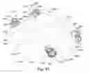 Fig. 43 - System and method for reducing and stabilizing fractures in bone, subluxations, or dislocations