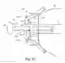 Fig. 05 - WASHER FOR SUPPORTING CABLE RELATIVE TO BONE