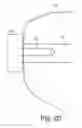 Fig. 06 - Washer assembly for stabilizing a bone