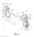 Fig. 12 - Washer assembly for stabilizing a bone