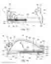 Fig. 17 - Washer assembly for stabilizing a bone
