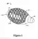 Fig. 02 - Cement-directing orthopedic implants