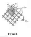 Fig. 06 - Cement-directing orthopedic implants