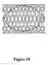 Fig. 11 - Cement-directing orthopedic implants